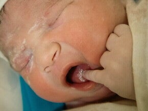 Close-up de um recém-nascido, com uma mãozinha na boca.