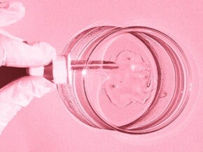Uma mão com luvas médicas, realiza a injeção de espermatozóides em um óvulo. Uma mão com luvas médicas, realiza a injeção de espermatozóides em um óvulo.