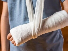  Criança com antebraço enfaixado, uma das mais comuns fraturas em crianças.