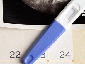 Imagem de um calendário com teste de gravidez e resultado de ultrassom. Imagem de um calendário com teste de gravidez e resultado de ultrassom.
