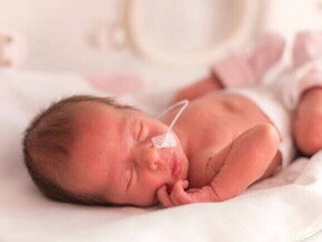 Um recém-nascido prematuro, deitado, com um suporte respiratório.