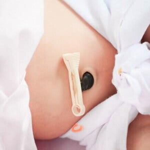 Umbigo de um bebê recém-nascido com o cordão umbilical cortado Umbigo de um bebê recém-nascido com o cordão umbilical cortado