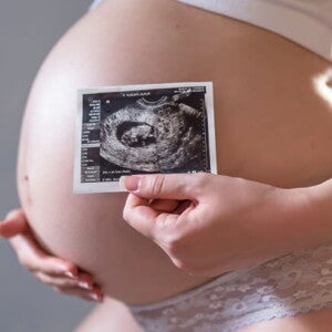 barriga grávida com uma das mãos posicionadas na barriga e a outra segurando a imagem de uma ultrassonografia barriga grávida com uma das mãos posicionadas na barriga e a outra segurando a imagem de uma ultrassonografia