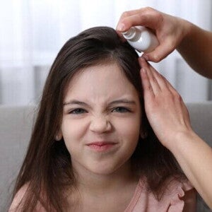 Menina com rosto irritado recebendo uma medicação no couro cabeludo Menina com rosto irritado recebendo uma medicação no couro cabeludo