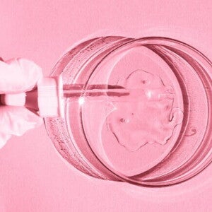 Uma mão com luvas médicas, realiza a injeção de espermatozóides em um óvulo. Uma mão com luvas médicas, realiza a injeção de espermatozóides em um óvulo.
