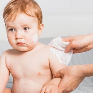 Imagem de mãe aplicando pomada em alergias na pele do bebê. Imagem de mãe aplicando pomada em alergias na pele do bebê.