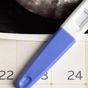 Imagem de um calendário com teste de gravidez e resultado de ultrassom. Imagem de um calendário com teste de gravidez e resultado de ultrassom.