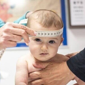 Profissionais de saúde medem a circunferência da cabeça de um bebê utilizando uma fita métrica, durante uma consulta de acompanhamento do desenvolvimento infantil. Profissionais de saúde medem a circunferência da cabeça de um bebê utilizando uma fita métrica, durante uma consulta de acompanhamento do desenvolvimento infantil.