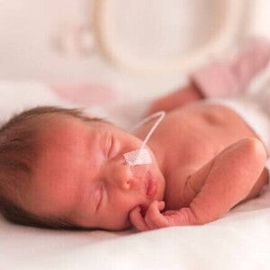 Um recém-nascido prematuro, deitado, com um suporte respiratório. Um recém-nascido prematuro, deitado, com um suporte respiratório.