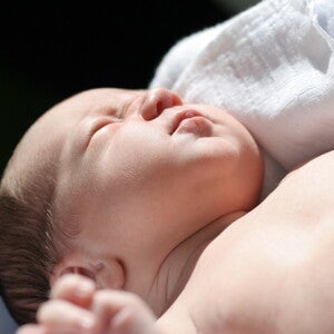 Icterícia neonatal: o que é, qual o tratamento indicado e outras informações Icterícia neonatal: o que é, qual o tratamento indicado e outras informações