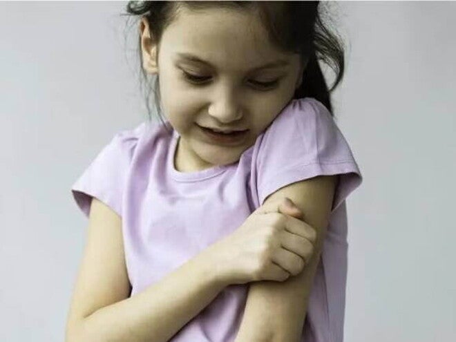 Alergia emocional Imagem de uma criança coçando o próprio braço, a coceira pode ser um dos sintomas de alergia emocional.