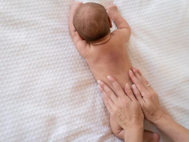 bebê com mancha mongólica nas costas deitado na cama bebê com mancha mongólica nas costas deitado na cama