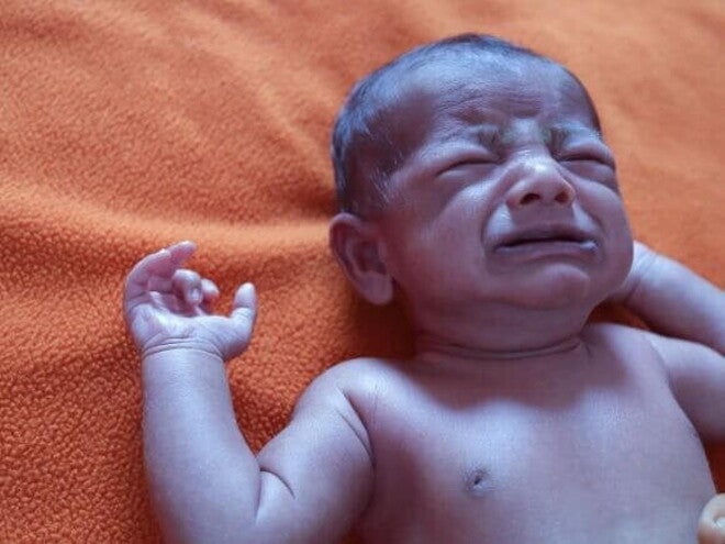 Um bebê recém-nascido deitado e chorando, com a pele em tom azulado. Um bebê recém-nascido deitado e chorando, com a pele em tom azulado.