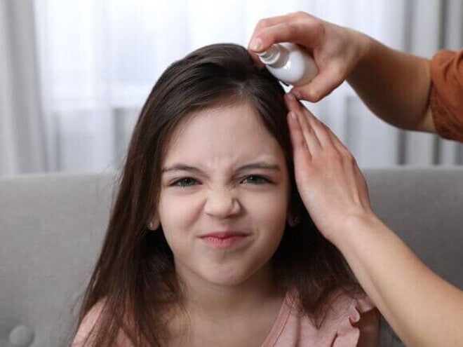Menina com rosto irritado recebendo uma medicação no couro cabeludo Menina com rosto irritado recebendo uma medicação no couro cabeludo