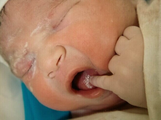 Close-up de um recém-nascido, com uma mãozinha na boca.