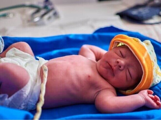 Um bebê recém-nascido deitado e de olhos fechados, ainda com o cordão umbilical Um bebê recém-nascido deitado e de olhos fechados, ainda com o cordão umbilical