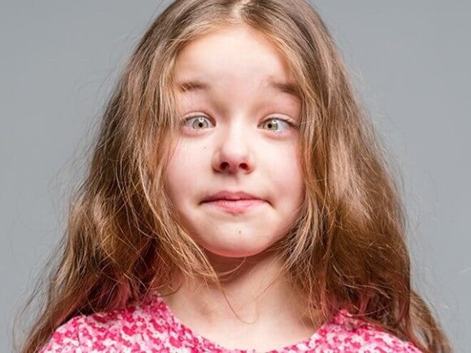 Imagem de menina com estrabismo. Imagem de menina com estrabismo.
