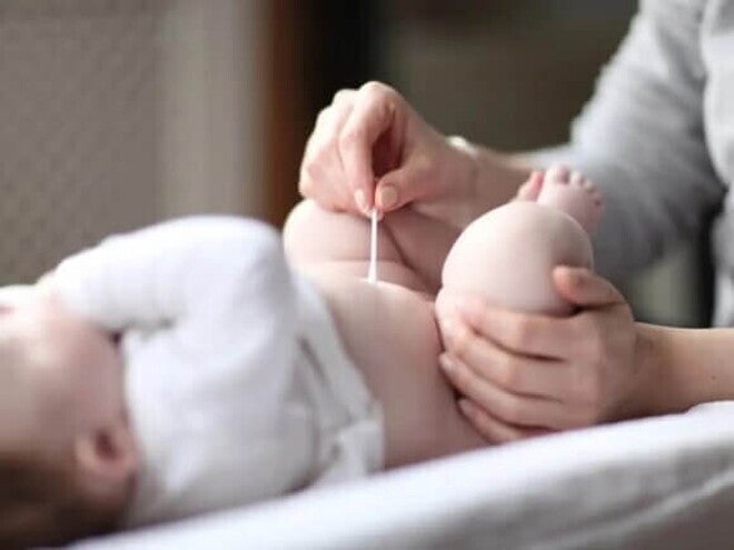 Mamãe limpando o cordão umbilical do bebê com um cotonete.