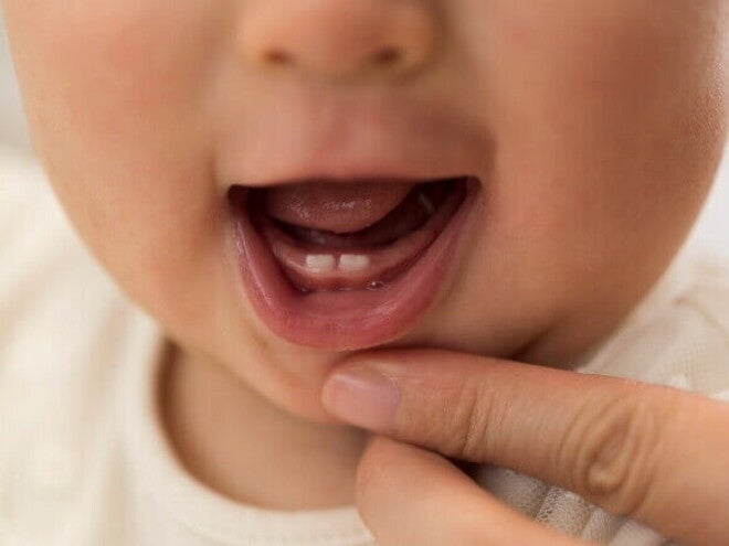 Close-up da boca de um bebê mostrando os primeiros dentinhos. Close-up da boca de um bebê mostrando os primeiros dentinhos.