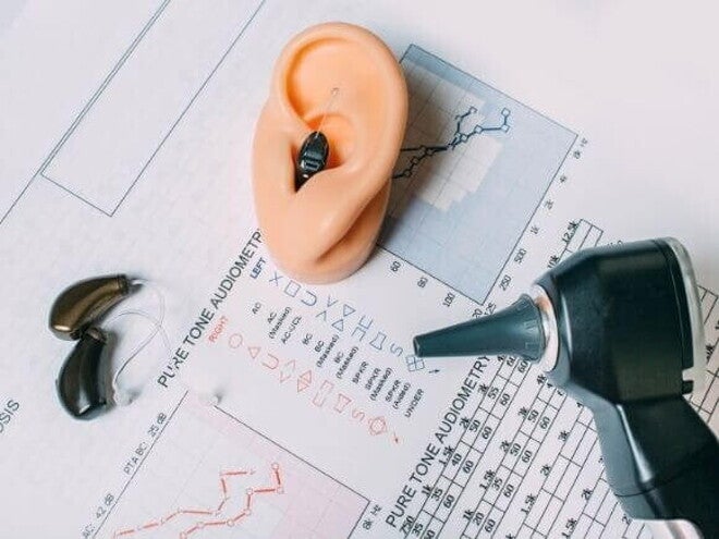 Diversos aparelhos voltados à saúde auditiva, dispostos em cima de um resultado de exame de audiometria Diversos aparelhos voltados à saúde auditiva, dispostos em cima de um resultado de exame de audiometria
