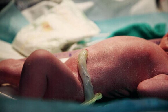 Detalhe do cordão umbilical de um bebê recém-nascido Detalhe do cordão umbilical de um bebê recém-nascido