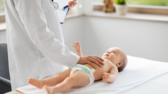 Assadura alergia alimentar Um médico com jaleco branco examina um bebê de fralda que está deitado em uma maca branca. O médico toca a barriga do bebê, que olha para cima. O exame pode ser para diagnosticar assadura por alergia alimentar ou outros problemas de pele infantil.