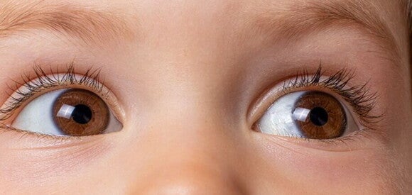 Conjuntivite2 Foto dos olhos de uma criança