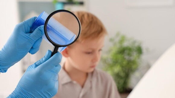 Um profissional de saúde analisa um pente de cabelo com uma lupa, Ao fundo, um menino está sentado Um profissional de saúde analisa um pente de cabelo com uma lupa, Ao fundo, um menino está sentado
