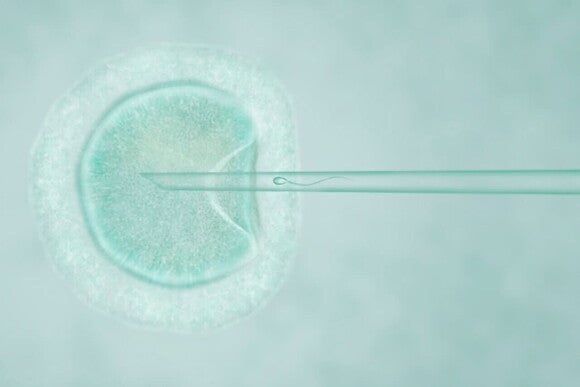 Ilustração de um espermatozoide sendo injetado em um óvulo. Ilustração de um espermatozoide sendo injetado em um óvulo.