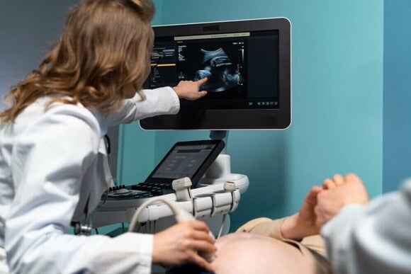 Profissional de saúde apontando para uma tela com um resultado de uma ultrassonografia Profissional de saúde apontando para uma tela com um resultado de uma ultrassonografia